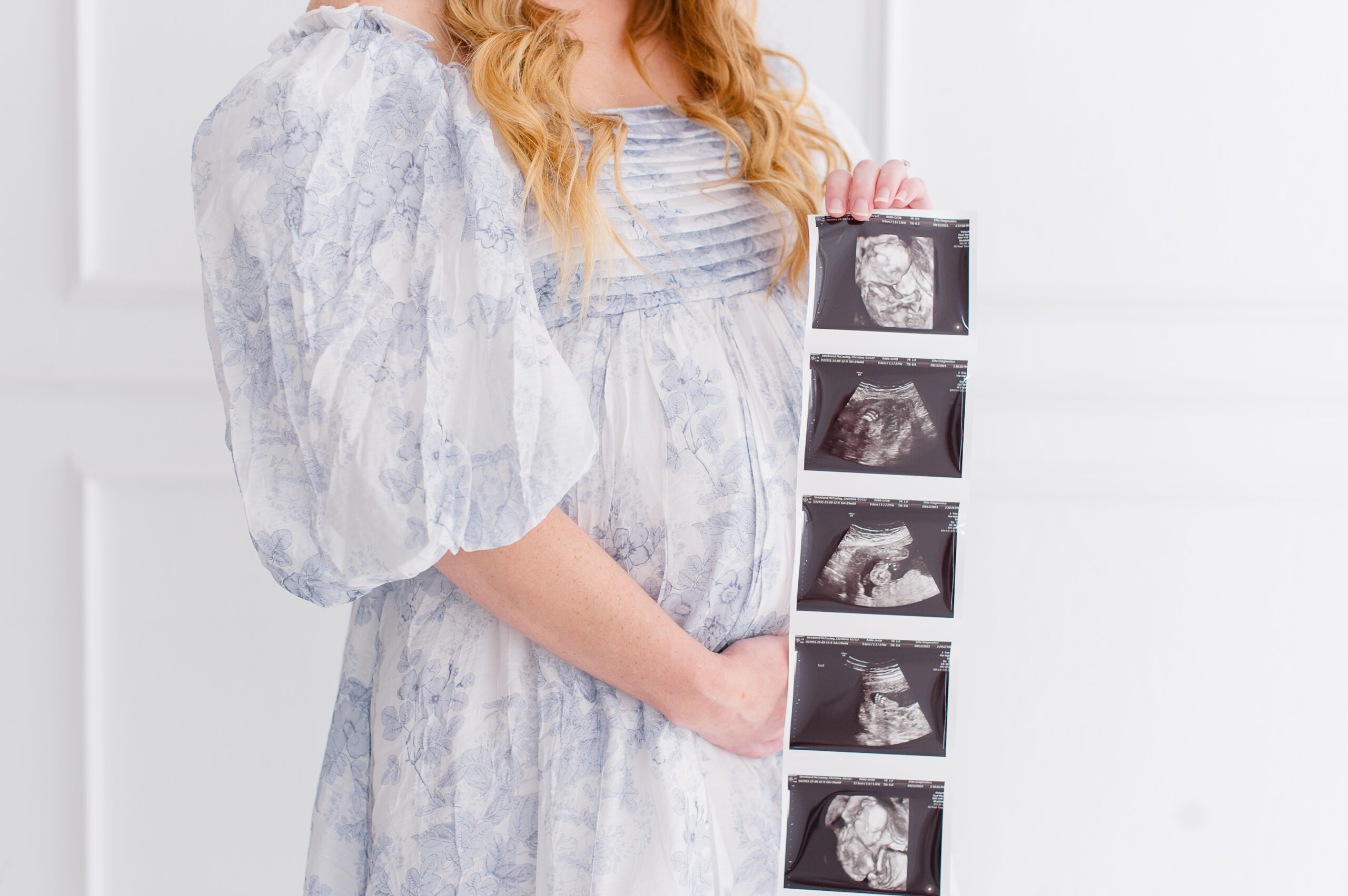 Closeup image of mom in blue floral dress while holding an ultrasound image Sacred Birth Midwifery